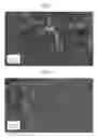Fig. 07 - Solid-state laser device