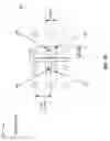 Fig. 07 - Clearance size reduction for backdrilled differential vias