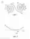 Fig. 02 - Apparatus and methods for securing jewelry