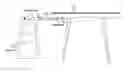 Fig. 01 - Debris catcher devices