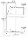 Fig. 17 - OPHTHALMIC DEVICE