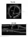 Fig. 10 - Calibration for OCT-NIRAF multimodality probe