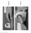 Fig. 18 - Finger blood pressure cuff