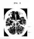 Fig. 07 - Computing system and method for identifying and visualizing cerebral thrombosis based on medical images