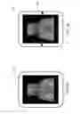 Fig. 06 - Systems and methods for image correction in an X-ray device