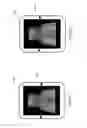 Fig. 07 - Systems and methods for image correction in an X-ray device