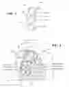 Fig. 04 - Auscultatory sound-or-vibration sensor