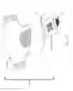 Fig. 10 - Collection device for diagnostics of vaginal discharge