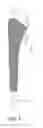 Fig. 02 - DISTALLY REAMING BROACH