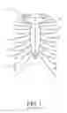 Fig. 02 - Sternum fixation device and method