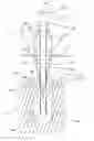 Fig. 01 - Dental implant system