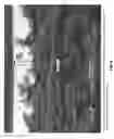 Fig. 09 - SURGICAL MESH HAVING INGROWTH-PREVENTING COATING ON ONE SIDE THEREOF, AND METHOD FOR MAKING THE SAME