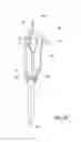 Fig. 06 - Adjustable fixation device