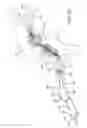 Fig. 35 - Adjustable fixation device