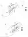 Fig. 05 - Prosthetic implant delivery device and method