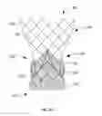Fig. 06 - Sutureless prosthetic heart valve