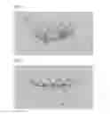 Fig. 02 - REPLACEMENT CARDIAC VALVE