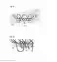 Fig. 09 - REPLACEMENT CARDIAC VALVE