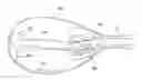 Fig. 01 - SYSTEMS AND METHODS FOR THE RETRIEVAL GALLBLADDER IMPLANTS