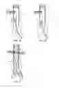 Fig. 06 - STENT DELIVERY BALLOON CATHETER ASSEMBLY AND METHOD OF OPERATING SAME