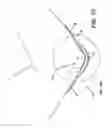 Fig. 09 - Extensible Dressings