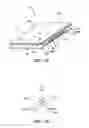 Fig. 02 - Extensible dressings