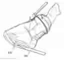 Fig. 01 - Medical pressure therapy device and components thereof