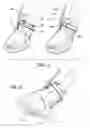 Fig. 04 - Medical pressure therapy device and components thereof