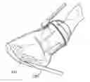 Fig. 01 - Medical pressure therapy device and components thereof