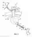 Fig. 03 - Bariatric device and method