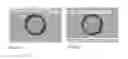 Fig. 04 - Ophthalmic drug sustained release device