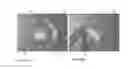 Fig. 07 - Ophthalmic drug sustained release device