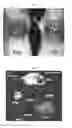 Fig. 02 - Method of preventing or treating radiation-induced dermatitis with extracellular vesicles