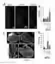 Fig. 08 - Method for treating melanoma using lymphangiogenesis inducers and a melanoma-specific antigen