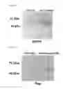 Fig. 08 - Method for delivery of biological molecule to nervous tissue