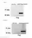 Fig. 09 - Method for delivery of biological molecule to nervous tissue