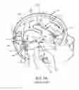 Fig. 02 - Lead fixation accessory, lead stabilization tool, and related procedures