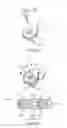 Fig. 09 - Lead fixation accessory, lead stabilization tool, and related procedures