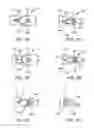 Fig. 17 - Lead fixation accessory, lead stabilization tool, and related procedures