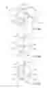 Fig. 30 - Lead fixation accessory, lead stabilization tool, and related procedures