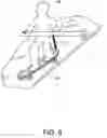 Fig. 07 - Torque stick apparatus and methods of use