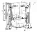 Fig. 01 - Fecal collection bag retention device for use in zero gravity