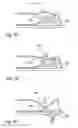 Fig. 08 - Package comprising a drinking device restricted to move in a pre-determined plane