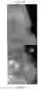 Fig. 18 - SOLID FORMS COMPRISING (1E, 4E)-2-AMINO-N,N-DIPROPYL-8-(4-(PYRROLIDINE-1-CARBONYL)PHENYL)-3H-BENZO[B]AZEPINE-4-CARBOXAMIDE, COMPOSITIONS THEREOF, AND USES THEREOF