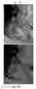 Fig. 22 - SOLID FORMS COMPRISING (1E, 4E)-2-AMINO-N,N-DIPROPYL-8-(4-(PYRROLIDINE-1-CARBONYL)PHENYL)-3H-BENZO[B]AZEPINE-4-CARBOXAMIDE, COMPOSITIONS THEREOF, AND USES THEREOF