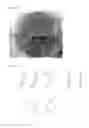 Fig. 02 - Cells for Therapy of the Heart