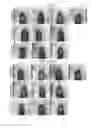 Fig. 01 - Methods and compositions for treating atherosclerosis