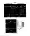 Fig. 65 - Methods and compositions for treating atherosclerosis