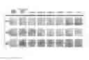 Fig. 01 - MARKER FOR PREDICTING PRESSURE ULCER DEVELOPMENT AND USE THEREOF