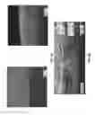 Fig. 08 - System and methods for deposition spray of particulate coatings